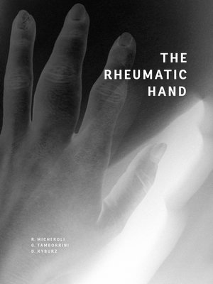 cover image of The Rheumatic Hand